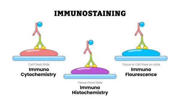 Bağışıklık kazandıran, eğitici tıbbi poster tasarımı sağlık hizmeti şeması etiketli ICC, Immunofluorescence IF, Immunohistokimya IHC