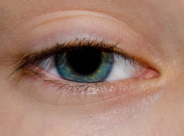 Blaues Auge Eines Teenagers Aus Nächster Nähe — Stockfoto
