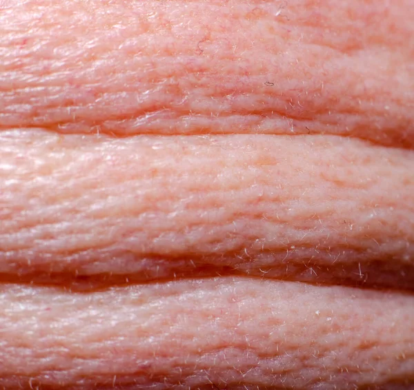 Wrinkles Scalp Adult Male — Stock Photo, Image