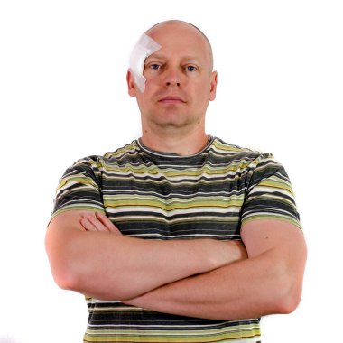 Cilt kanseri ameliyatından sonra kafasında sıva olan yetişkin bir adam.