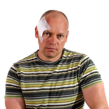 Cilt kanseri ameliyatından sonra kafasında sıva olan yetişkin bir adam.