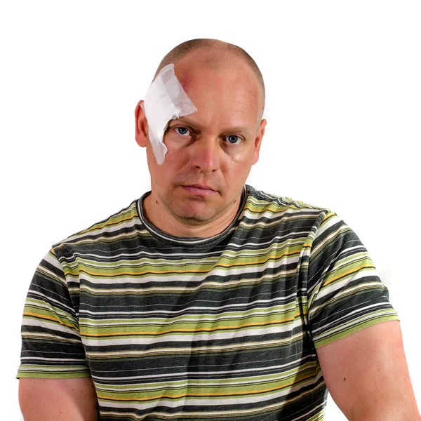 Cilt kanseri ameliyatından sonra kafasında sıva olan yetişkin bir adam.