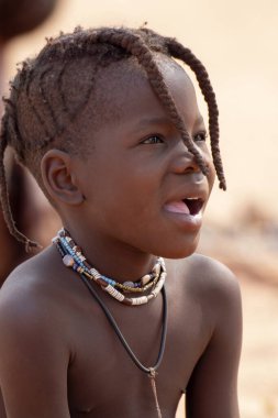 Koca kafalı bir çocuk.