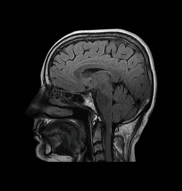 İnsan beyin MR 'ının ayrıntılı sagital kesiti gri tonda karmaşık sinirsel yapılar ve anatomi gösteriyor..