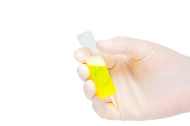 Gloved hand holding test tube with yellow liquid on isolated white background. Close up of gloved hand with yellow filled glass test tube. Science, research and laboratory concept