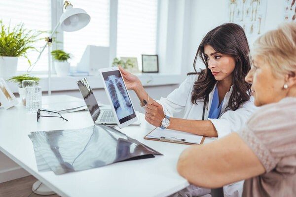 Doctor and patient discussing scan results in hospital. Doctor checking examining chest x-ray film of patient at ward hospital. Doctor examining at lungs radiograph x-ray film of patient. Medical concept.