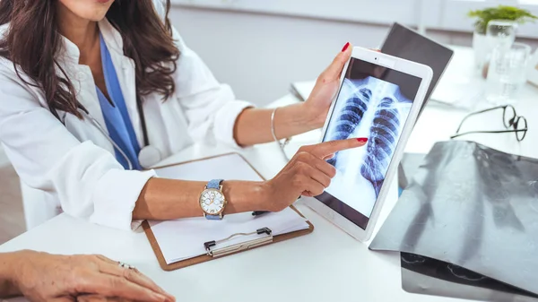 肺疾患 骨癌疾患の患者の健康診断のための放射線胸部X線フィルムを持つ医師 肺がん医療 医師は デジタルタブレット上のX線スキャンチェストから肺チェックの結果を説明 — ストック写真