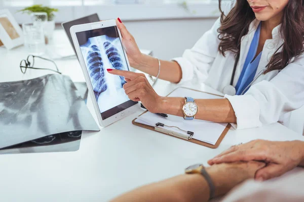 Doctor shows results to old patient x-ray of the lungs, smoking cigarettes problem. Doctor explaining lungs x-ray on Tablet PC screen to young patient. Doctor showing female patient x-ray shot in clinic office. Coronavirus chest X-ray.