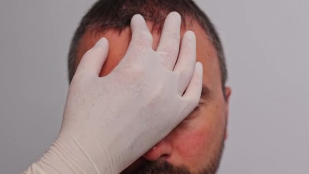 男人的额头有粉刺红斑皮肤病水痘或疱疹的概念 — 图库视频影像