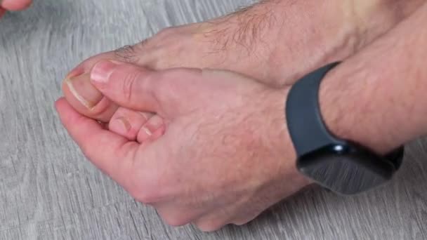 Чоловік Ріже Нігті Ножицями Чоловічі Нарізані Нігті Пішки Догляд Ногами — стокове відео