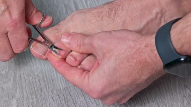 Чоловік Ріже Нігті Ножицями Чоловічі Нарізані Нігті Пішки Догляд Ногами — стокове відео
