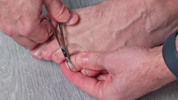 ハサミで爪を切った男 男性は足で爪を切りました フットケア — ストック動画