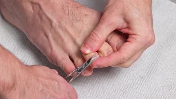 ハサミで爪を切った男 男性は足で爪を切りました フットケア — ストック動画