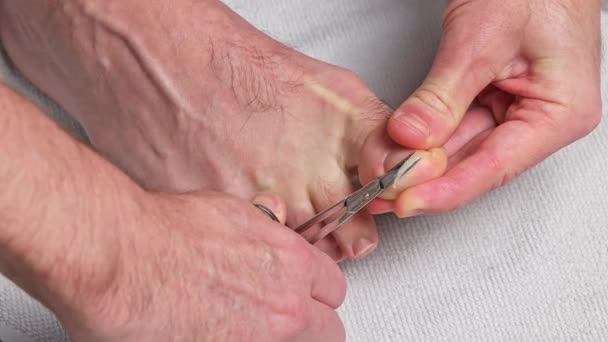 Ayak Tırnaklarını Makasla Kesen Adam Erkek Ayak Tırnakları Yaya Olarak — Stok video