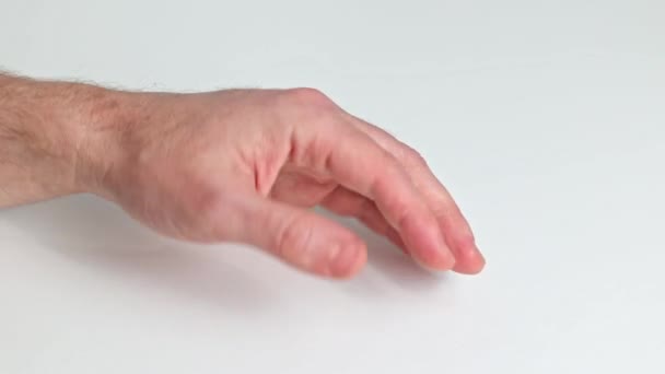 Man Turns His Palm Shows Wound Heat Burn Burnt Skin — Stock Video