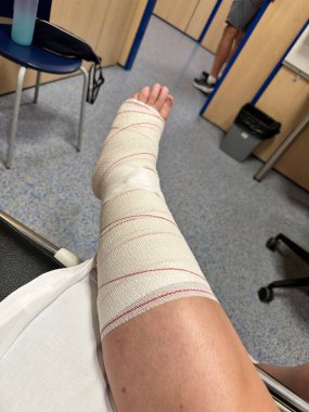 Hastane bekleme salonunda bacağı bandajlı..