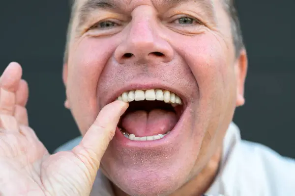 Extreme Close Man Holding His Dental Prosthesis His Thumb Black — Stock Photo, Image