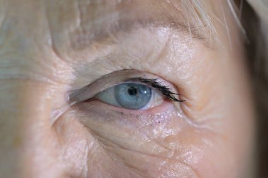 Mavi bir gözün çarpıcı bir yakın çekimi, iris detaylarını ve hassas yansımalarını ortaya çıkarıyor..