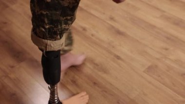 prosthetic legs, Military heroes, Injured soldiers. Amputee and military officer with leg prostheses, veteran showing war scars, ukrainian soldier has just had leg amputated is being rehabilitated