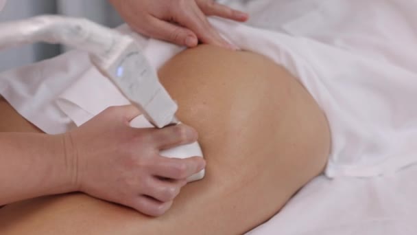 Hardware Correctie Niet Invasieve Methode Roller Massage Aantrekkelijke Jonge Vrouw — Stockvideo
