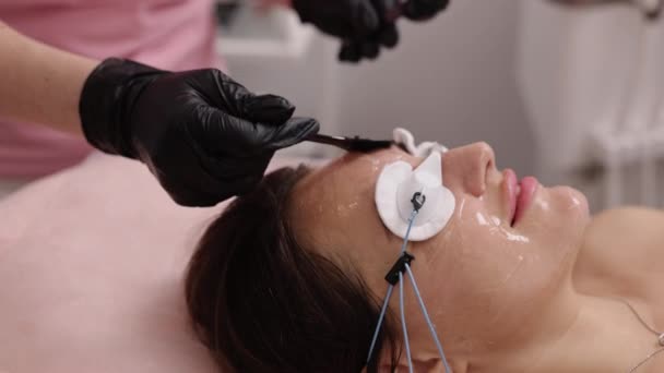 Epilace Ženská Kůže Epilační Gel Kosmetolog Nanáší Ultrazvukový Gel Ženskou — Stock video