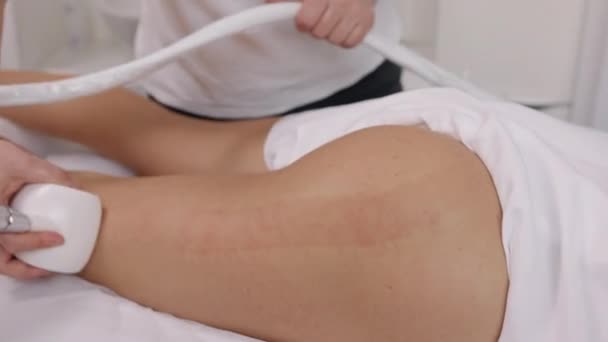 Ultraschallbehandlung Massagegerät Schönheitsklinik Attraktive Junge Frau Nimmt Schönheitsdiensten Körperformen Und — Stockvideo