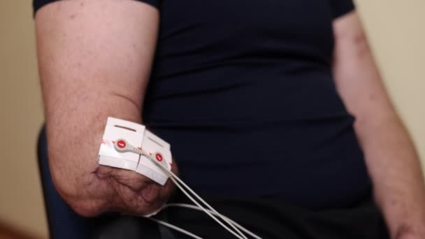 リハビリテーション技術 エレクトロセラピー手順 筋肉調節 電気療法のための電極が適用される患者の腕のイメージズームは 非侵襲的なアプローチを強調します — ストック動画