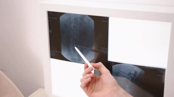 Analisis Spinal Poin Tangan Penilaian Gambar Close View Hand Pointing — Stok Video