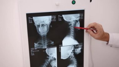 Kırmızı İşaretçi, Omurga Analizi, Görüntüleme Odağı. Yakın plan doktorlar el fener kutusundaki omurilik X-ray görüntülerinin belirli bölgelerini vurgulamak için kırmızı işaret kullanır.