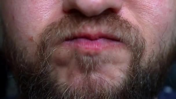 Giovane Con Barba Cerca Qualcosa Incastrato Nel Dente — Video Stock