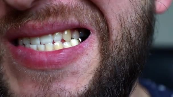 Mladý Muž Plnovousem Prohlíží Zuby — Stock video