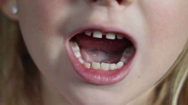 小孩正试着把一颗缺了的牙拔掉 — 图库视频影像