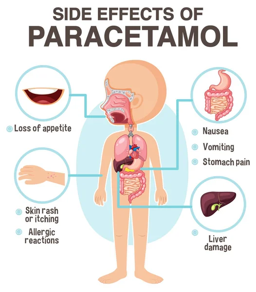 Human Anatomy Diagram Cartoon Style Paracetamol Side Effects Illustration — Wektor stockowy