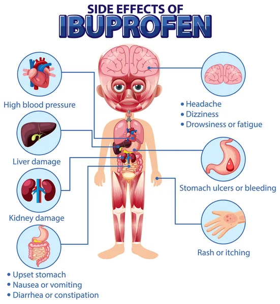 Diagramma Anatomia Umana Stile Cartone Animato Ibuprofene Effetti Collaterali Illustrazione — Vettoriale Stock