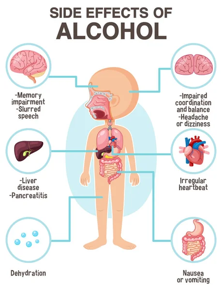 Mänsklig Anatomi Diagram Tecknad Stil Alkohol Biverkningar Illustration — Stock vektor