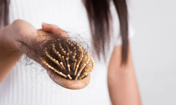Woman hand holding a comb with hair loss on white background. Health care and medical, Hair loss problem concept.