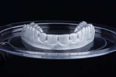 Eski vakum tarafından polimer plastikten yapılan bruksizme karşı şeffaf diş bandı.