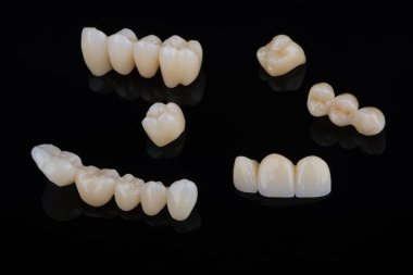 Yüksek estetik zirkon protezleri ve siyah arka planda taçlar. Zirkon köprüleri ve diş kaplamaları setinin üst görüntüsü