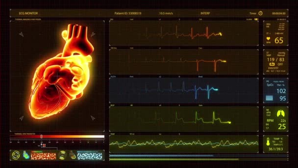Vykreslování Smyčky Elektrokardiogramu Monitoru Ecg — Stock video