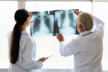 Hastane steril odasında, iki profesyonel radyolog tıbbi röntgen teşhisi için bir radyografı tutuyor ve inceliyor. Acemi doktor tecrübeli yaşlı doktordan hasta durumuyla ilgili tavsiye ister..