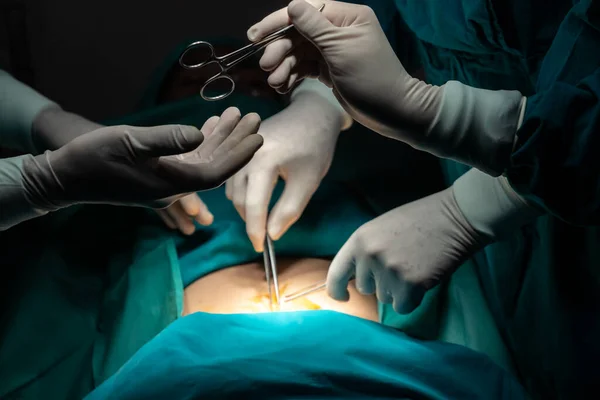 Bild Des Chirurgenteams Führt Operation Durch Krankenschwester Reicht Dem Chirurgen — Stockfoto