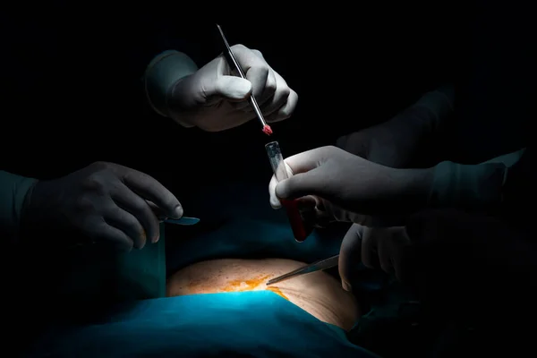 Zbliżenie Zespołu Chirurgicznego Wykonującego Operację Pacjentowi Sterylnej Sali Operacyjnej Sali — Zdjęcie stockowe