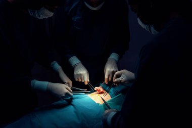 Steril ameliyathanede hastaya ameliyat yapan cerrahi ekip. Bir lambanın yaktığı ameliyathanede, profesyonel ve kendinden emin bir cerrahi ekip bilinçsiz hastaya tıbbi bakım sağlar..