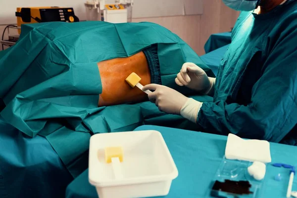 Лікар Або Хірург Застосовують Бетадін Пацієнта Єкції Анестезії Щоб Зменшити — стокове фото