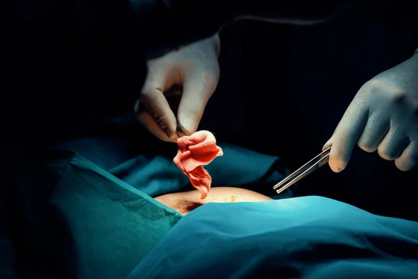 Équipe Chirurgicale Rapprochée Effectuant Une Chirurgie Patient Salle Opération Stérile — Photo