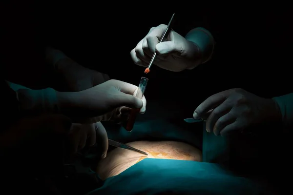 Equipo Quirúrgico Primer Plano Realizando Cirugía Paciente Quirófano Estéril Una —  Fotos de Stock