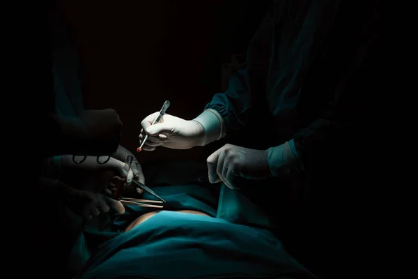 Крупним Планом Хірургічна Команда Виконує Операцію Пацієнту Стерильній Операційній Кімнаті — стокове фото