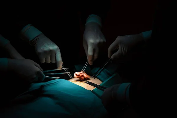 Closeup Chirurgische Team Het Uitvoeren Van Een Operatie Aan Patiënt — Stockfoto