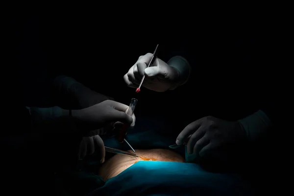Zbliżenie Zespołu Chirurgicznego Wykonującego Operację Pacjentowi Sterylnej Sali Operacyjnej Sali — Zdjęcie stockowe