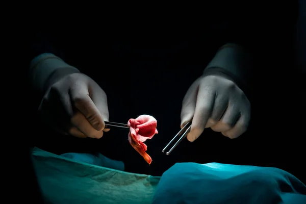 Closeup Surgical Team Performing Surgery Patient Sterile Operating Room Surgery — Stock Photo, Image